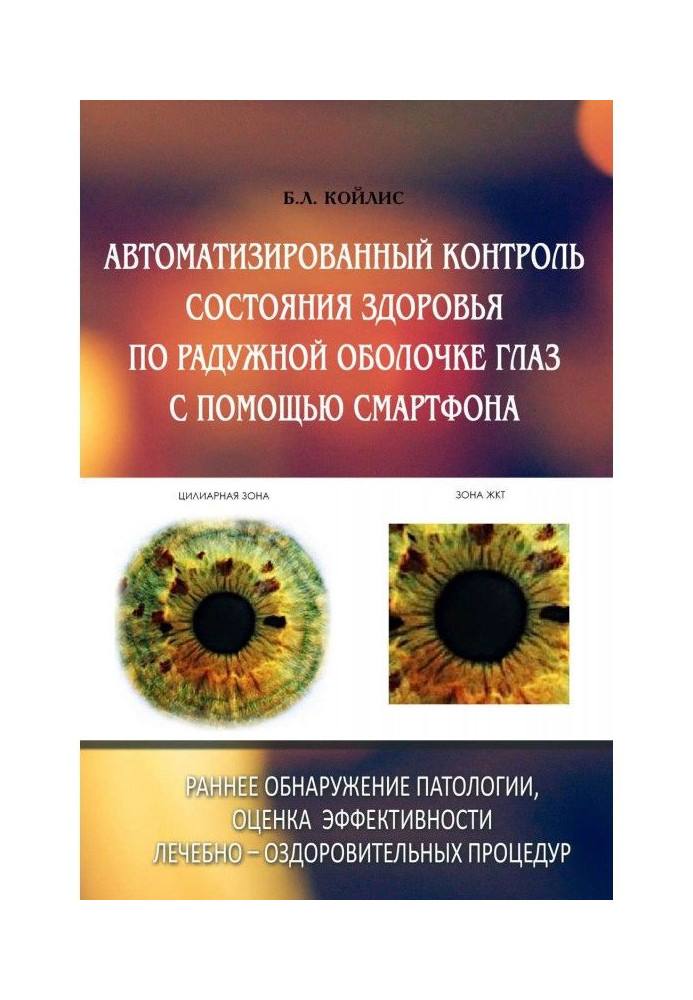 Автоматизований контроль стану здоров'я по веселковій оболонці очей за допомогою смартфону