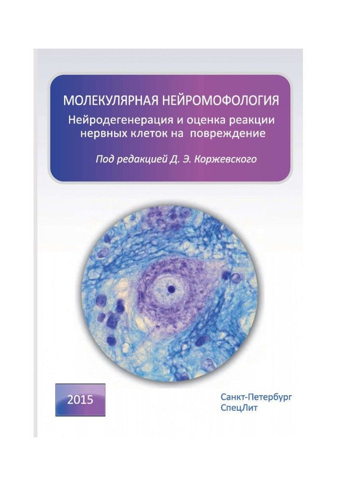 Molecular neuromorphology. Neurodegeneration and assessment of the response of nerve cells to damage