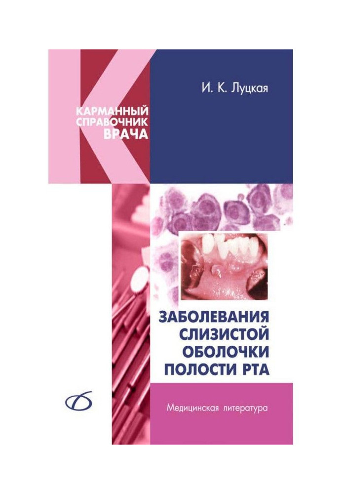 Захворювання слизової оболонки порожнини рота