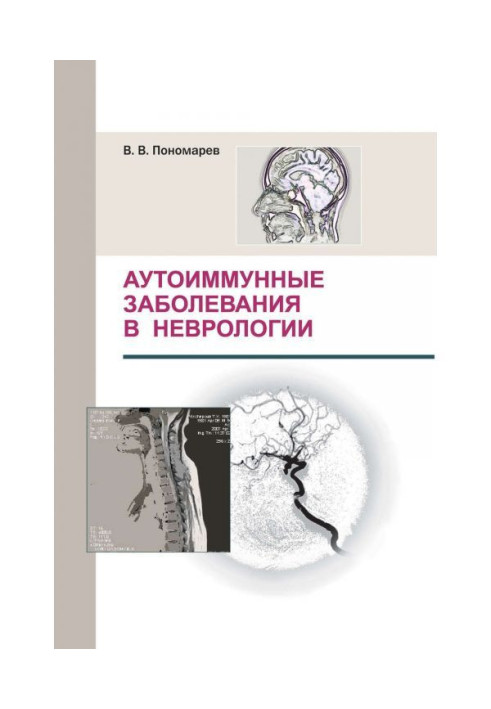 Аутоіммунні захворювання в неврології