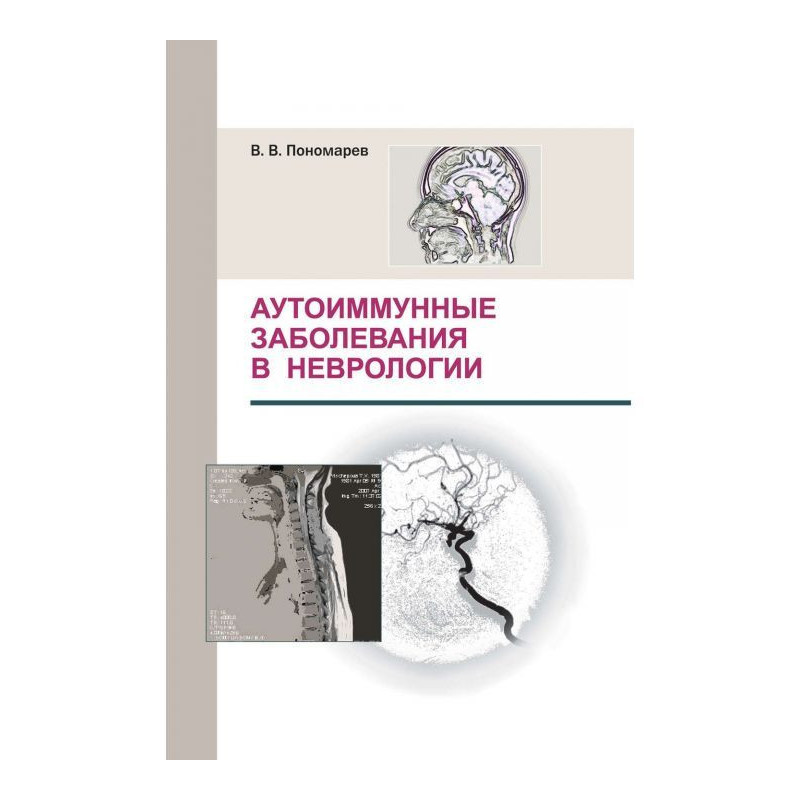 Аутоиммунные заболевания в...