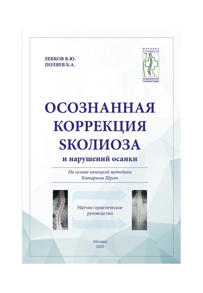 Усвідомлена корекція сколіозу і порушень осанки