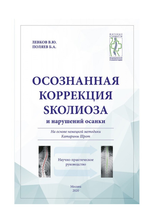 Усвідомлена корекція сколіозу і порушень осанки