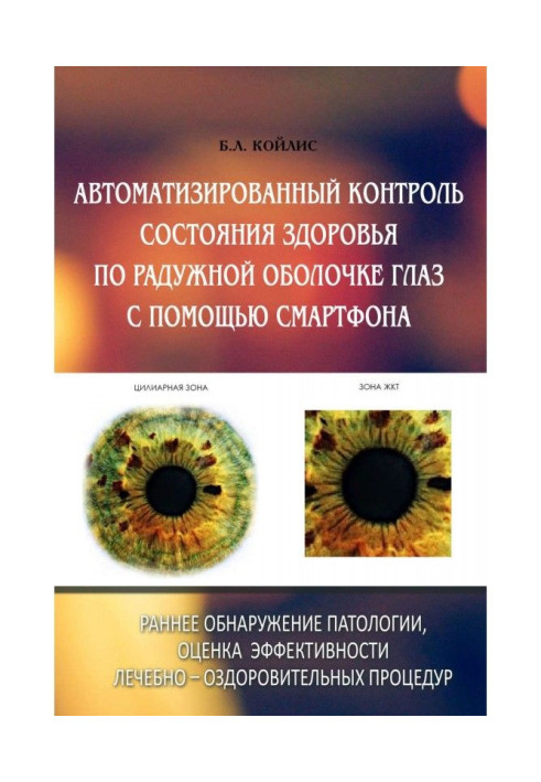 Automated control of the state of health on the iris of eyes by means of смартфона