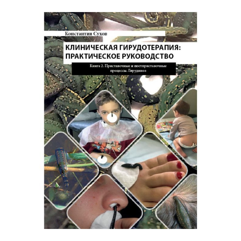 Клиническая гирудотерапия:...