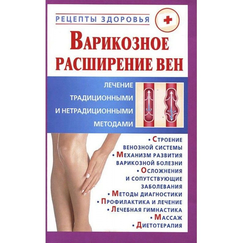 Варикозне розширення вен....