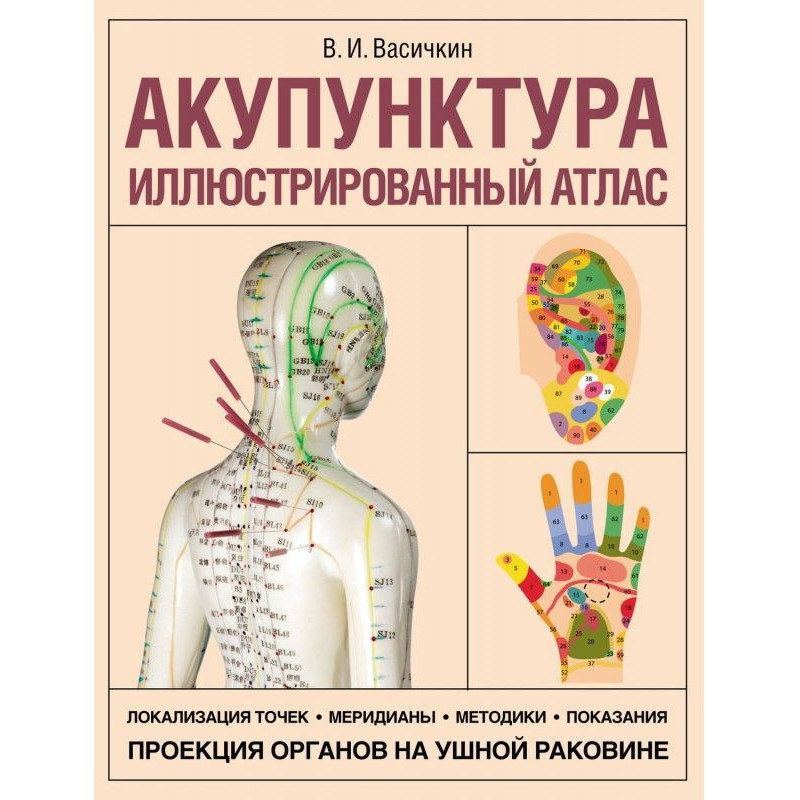 Акупунктура....