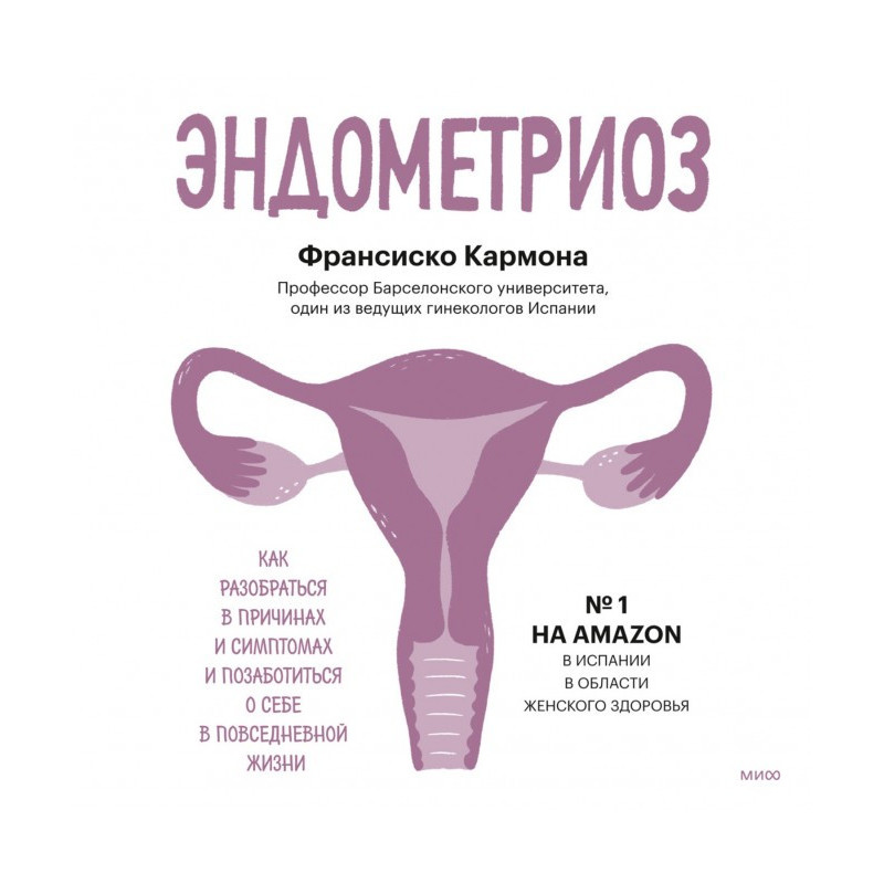 Ендометріоз. Як розібратися...