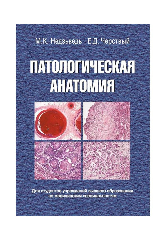 Патологічна анатомія