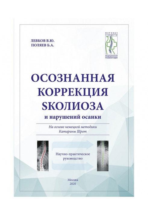 Осознанная коррекция сколиоза и нарушений осанки