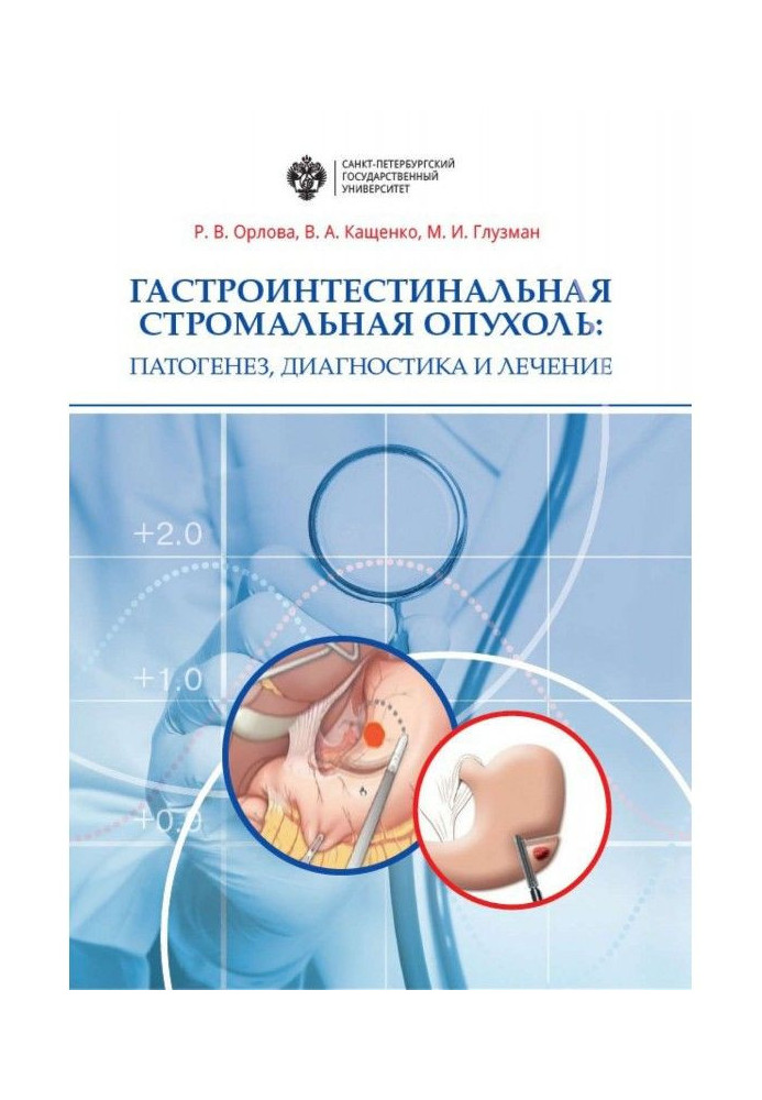 Гастроинтестинальная стромальная опухоль. Патогенез, диагностика и лечение