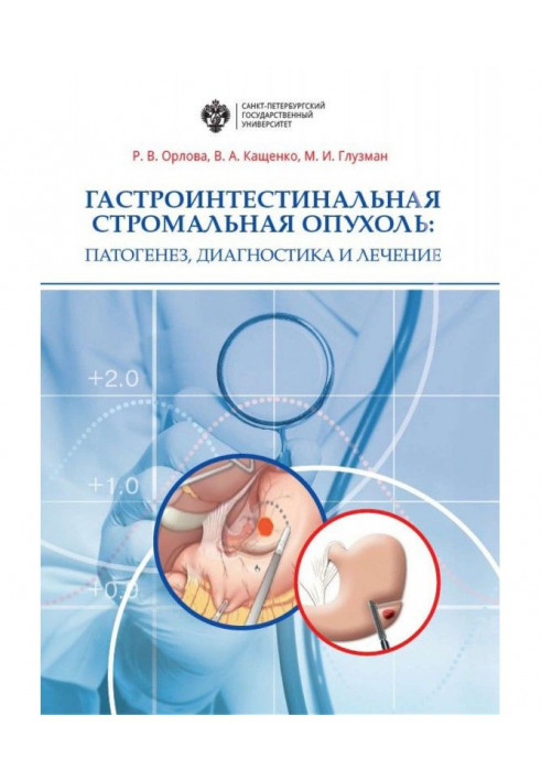 Гастроинтестинальная стромальная опухоль. Патогенез, диагностика и лечение