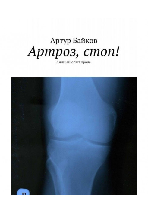 Arthrosis, feet! Personal experience of doctor