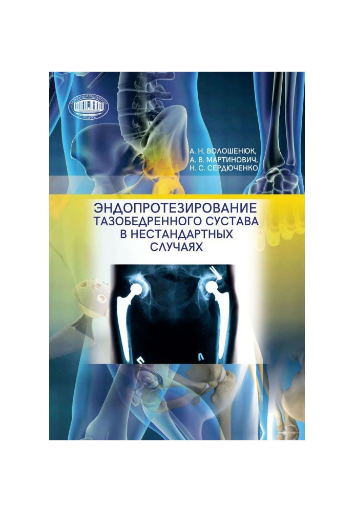 Endoprosthetics of the hip joint in non-standard cases