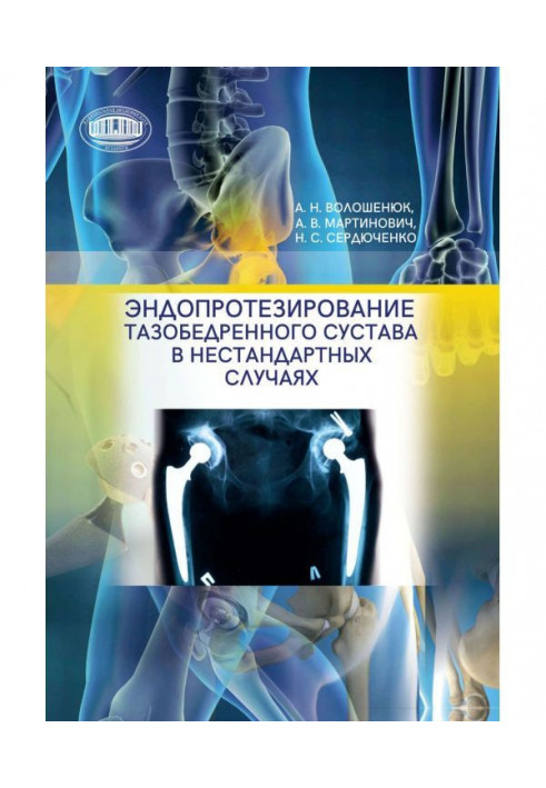 Эндопротезирование тазобедренного сустава в нестандартных случаях