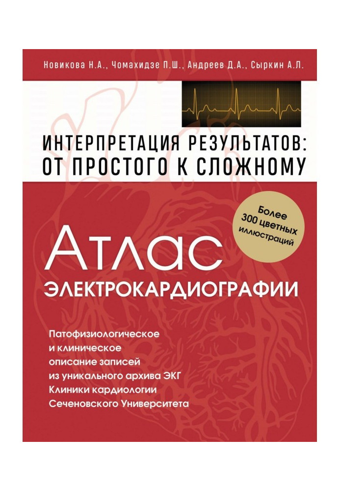 Атлас электрокардиографии. Интерпретация результатов: от простого к сложному