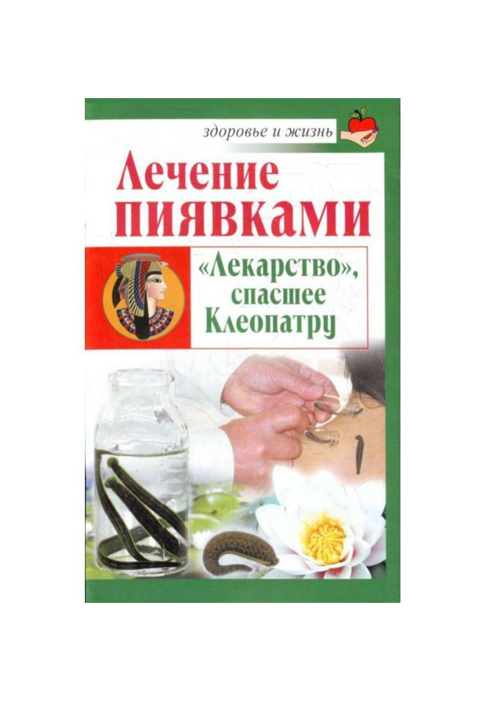 Лікування п'явками. «Ліки», що врятували Клеопатру