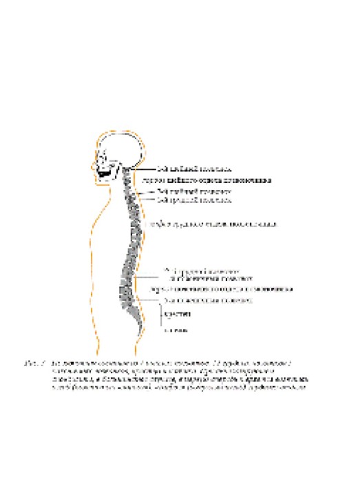 Ankylosing spondylitis