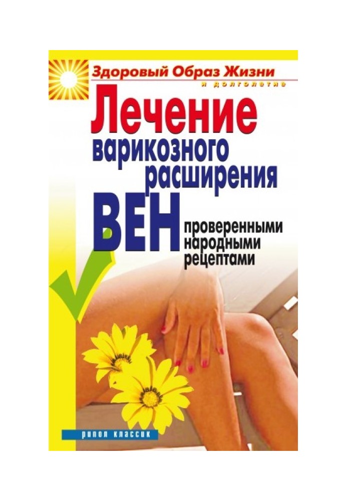 Treatment of varicose veins with proven folk recipes