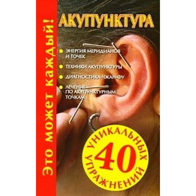 Акупунктура