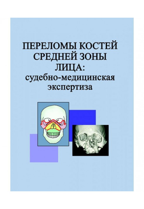 Переломи кісток середньої зони особи: судово-медична експертиза