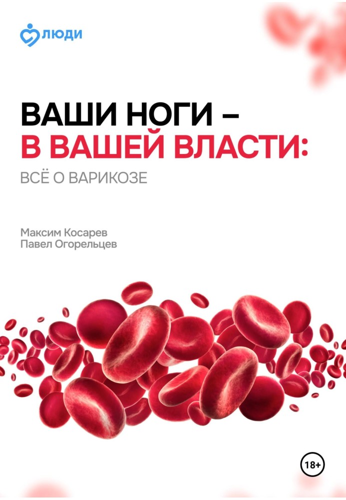 Ваші ноги – у вашій владі: все про варикоз