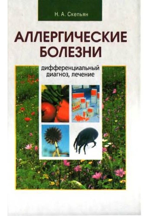 Алергічні хвороби: диференціальний діагноз, лікування