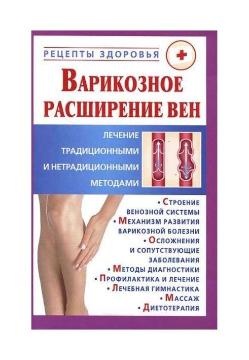 Варикозне розширення вен. Лікування традиційними і нетрадиційними методами