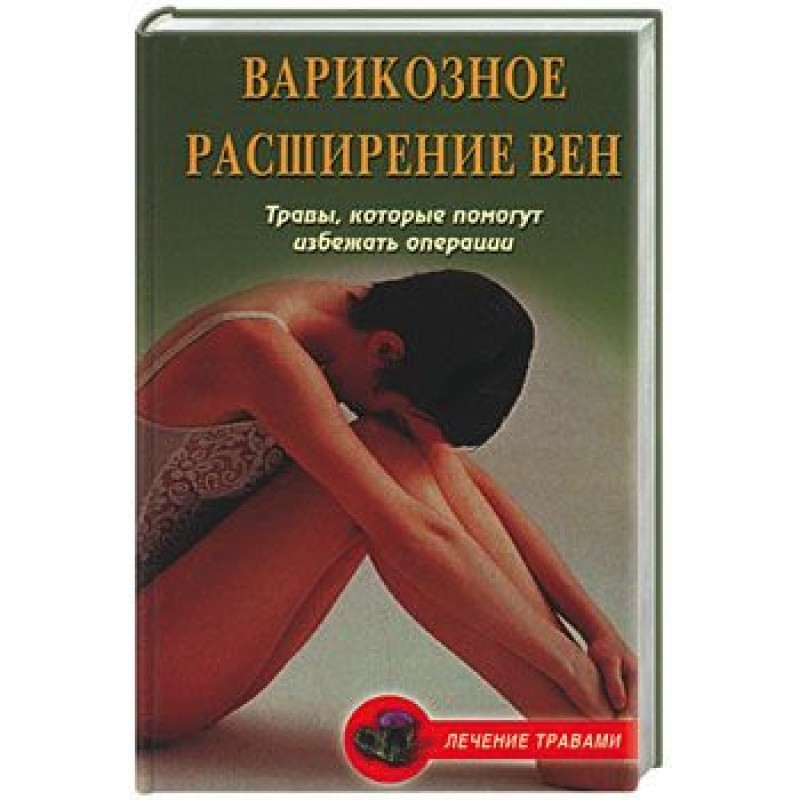 Phlebeurysm. Herbs to help...