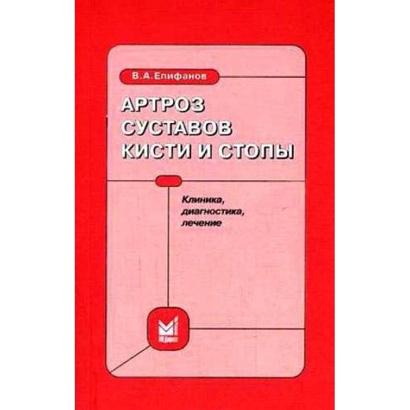 Артроз суглобів кисті та...