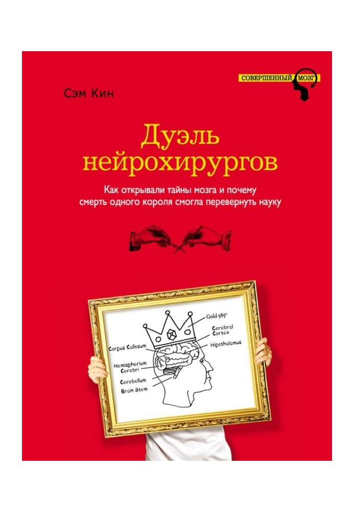 Дуель нейрохірургів. Як відкривали таємниці мозку і чому смерть одного короля змогла перевернути науку