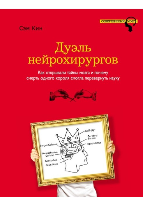 Дуель нейрохірургів. Як відкривали таємниці мозку і чому смерть одного короля змогла перевернути науку