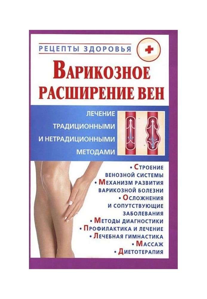 Варикозне розширення вен. Лікування традиційними і нетрадиційними методами