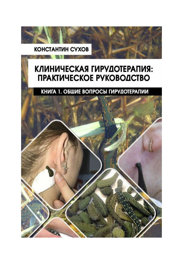 Клінічна гірудотерапія: практичне керівництво. Книга 1. Загальні питання гірудотерапії