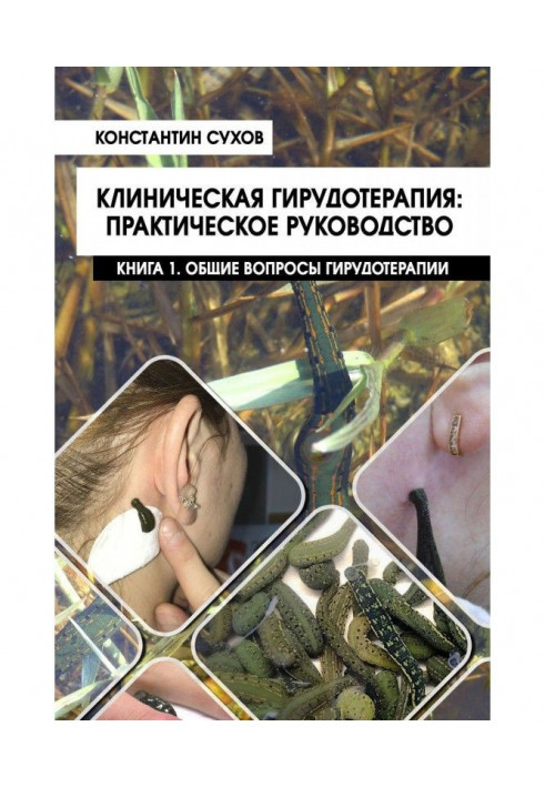 Клінічна гірудотерапія: практичне керівництво. Книга 1. Загальні питання гірудотерапії