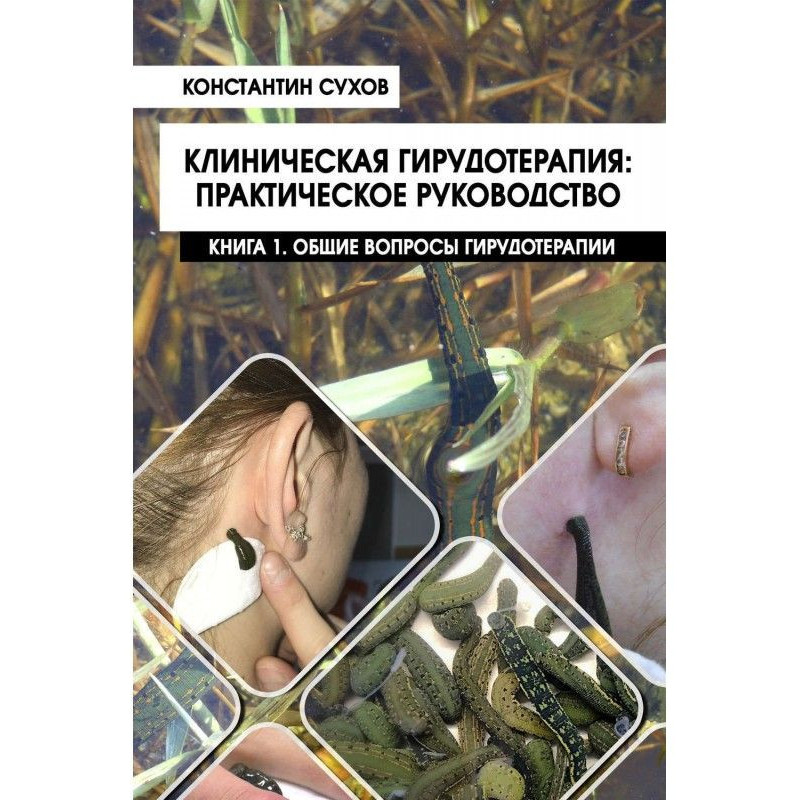 Клиническая гирудотерапия:...
