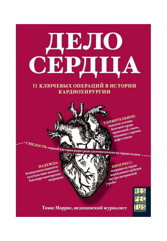 Справа серця. 11 ключових операцій в історії кардіохірургії