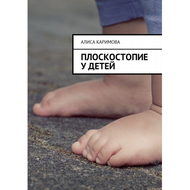 Плоскостопість у дітей