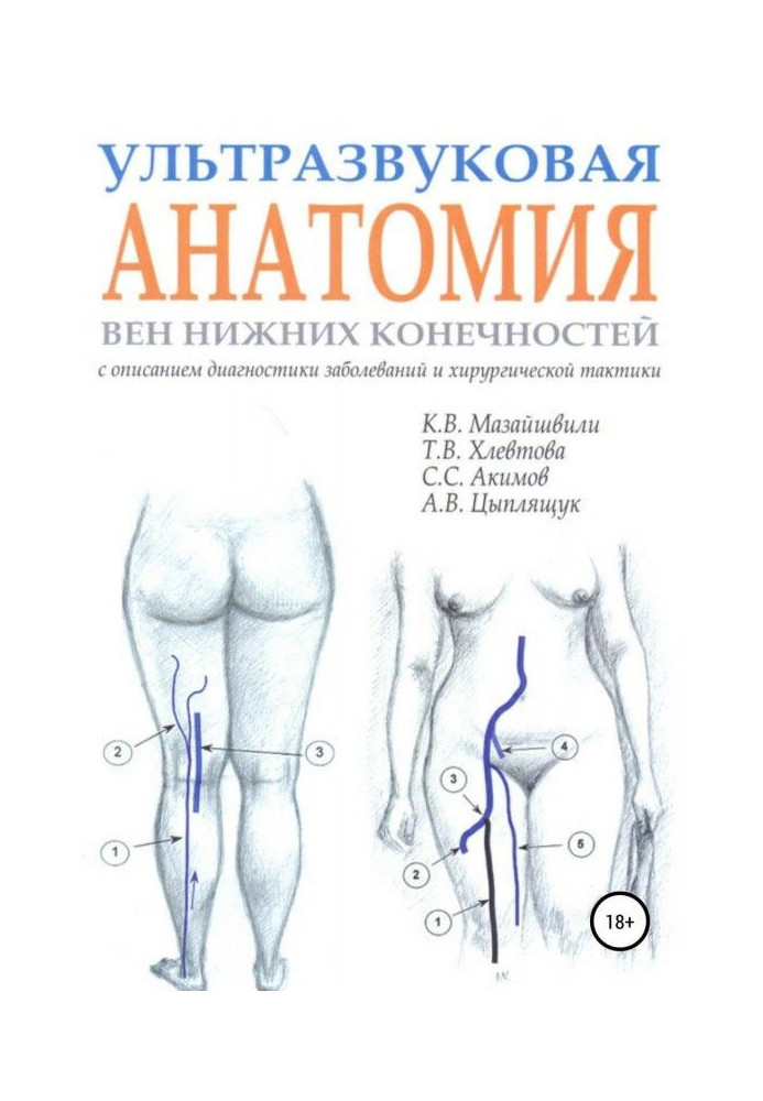 Ultrasonic anatomy of veins of lower limbs