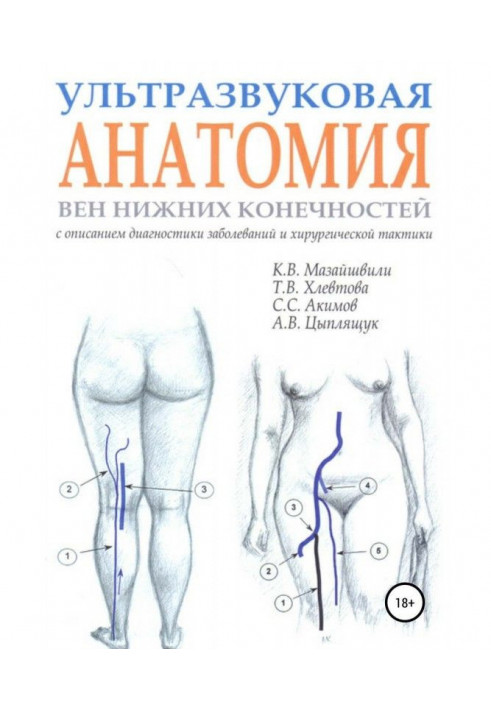 Ultrasonic anatomy of veins of lower limbs